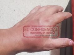 Policías lo golpean y le roban dinero a joven en Minatitlán