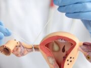 IMSS Veracruz Sur realizará salpingoclasia para derechohabientes y no derechohabientes